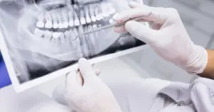 Pessoa segurando instrumentos odontológicos e, ao fundo, uma imagem de raio-x de dentes.